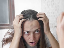 Tips To Get Rid Of Premature Greying Of Hair Tips To Get Rid Of Premature Greying Of Hair