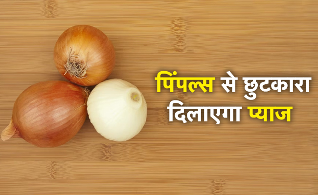 Onion Face Pack: चेहरे से पिंपल्स को दूर भगाता है प्याज का फेस पैक, जल्दी से जान लीजिए इसे बनाने का तरीका