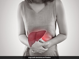 Liver Health: लीवर की सेहत अच्छी रखते हैं ये 5 फूड, डाइट में शामिल करने पर स्वास्थ्य संबंधी दिक्कतों से मिलेगा छुटकारा  Liver Health: लीवर की सेहत अच्छी रखते हैं ये 5 फूड, डाइट में शामिल करने पर स्वास्थ्य संबंधी दिक्कतों से मिलेगा छुटकारा
