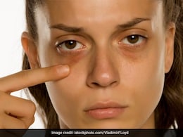 डार्क सर्कल हटाने के लिए 3 कारगर घरेलू उपाय, महंगे प्रोडक्ट्स नहीं बस ये चीज लगाएं डार्क सर्कल हटाने के लिए 3 कारगर घरेलू उपाय, महंगे प्रोडक्ट्स नहीं बस ये चीज लगाएं