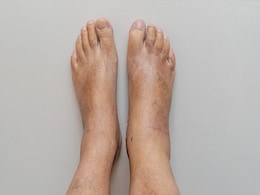 शरीर में रहती है Swelling! तो सकती हैं ये 5 Disease, जानें सूजन के 5 खतरनाक कारण और जोखिम शरीर में रहती है Swelling! तो सकती हैं ये 5 Disease, जानें सूजन के 5 खतरनाक कारण और जोखिम