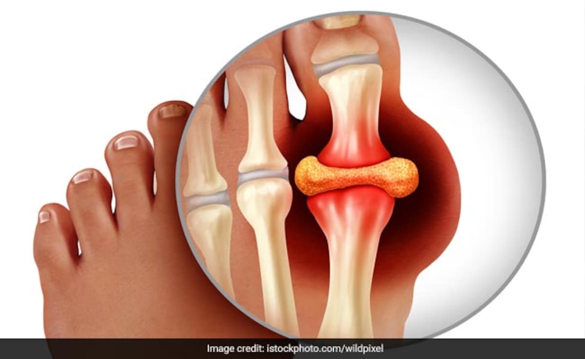 Latest and Breaking News on NDTV Latest and Breaking News on NDTV