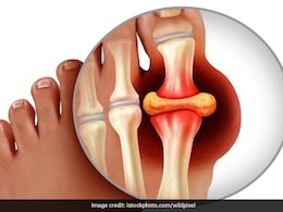 शरीर में बढ़े यूरिक एसिड को करना है खत्म तो खाएं इस आटे से बनी रोटी, जड़ से खत्म होगा Uric Acid शरीर में बढ़े यूरिक एसिड को करना है खत्म तो खाएं इस आटे से बनी रोटी, जड़ से खत्म होगा Uric Acid