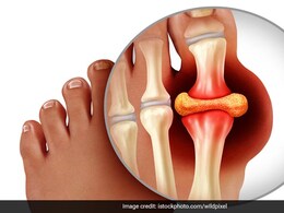 यूरिक एसिड बढ़ने से हो सकती हैं कई परेशानियां, जानें Uric Acid Control करने के लिए क्या खाना है फायदेमंद यूरिक एसिड बढ़ने से हो सकती हैं कई परेशानियां, जानें Uric Acid Control करने के लिए क्या खाना है फायदेमंद