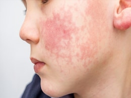 चेहरे में होने वाले ये बदलाव होते हैं हाई Cholesterol के लक्षण, बिल्कुल ना करें इग्नोर चेहरे में होने वाले ये बदलाव होते हैं हाई Cholesterol के लक्षण, बिल्कुल ना करें इग्नोर