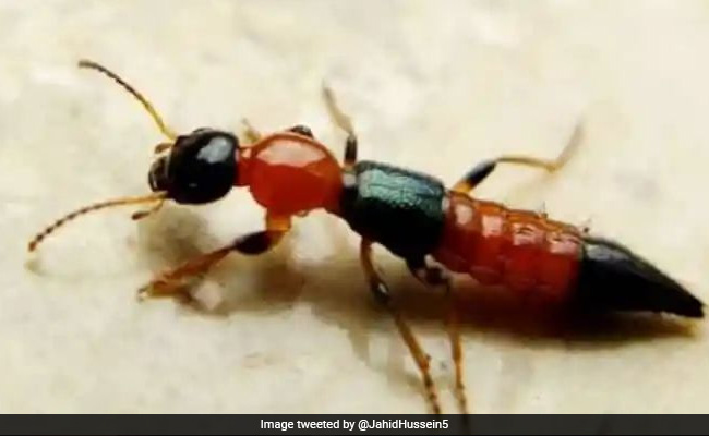Nairobi Flies Infect Sikkim Students: All You Need To Know About Skin-Burning Insects