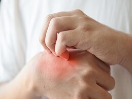 Dry Skin In Summer: धूप और ड्राईनेस के कारण स्किन में होने लगी है खुजली तो अपनाएं ये नुस्खे, तुरंत मिलेगा आराम Dry Skin In Summer: धूप और ड्राईनेस के कारण स्किन में होने लगी है खुजली तो अपनाएं ये नुस्खे, तुरंत मिलेगा आराम