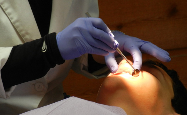 UK Dentists Warn People Against Viral "Turkey Teeth" Trend. Here's Why