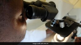 क्या है घातक मारबर्ग वायरस? रवांडा में मचा रहा कोहराम, कैसे फैल रहा है ये रवांडा वायरस? जानें लक्षण