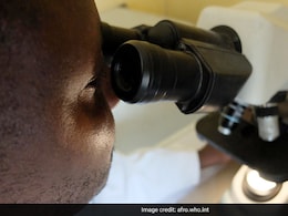 क्या है घातक मारबर्ग वायरस? रवांडा में मचा रहा कोहराम, कैसे फैल रहा है ये रवांडा वायरस? जानें लक्षण क्या है घातक मारबर्ग वायरस? रवांडा में मचा रहा कोहराम, कैसे फैल रहा है ये रवांडा वायरस? जानें लक्षण