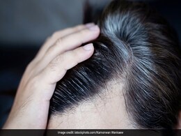अगर आपके भी बाल समय से पहले हो रहे हैं सफेद तो बस आजमा लीजिए यह नुस्खा, दूर हो जाएगी White Hair की दिक्कत अगर आपके भी बाल समय से पहले हो रहे हैं सफेद तो बस आजमा लीजिए यह नुस्खा, दूर हो जाएगी White Hair की दिक्कत
