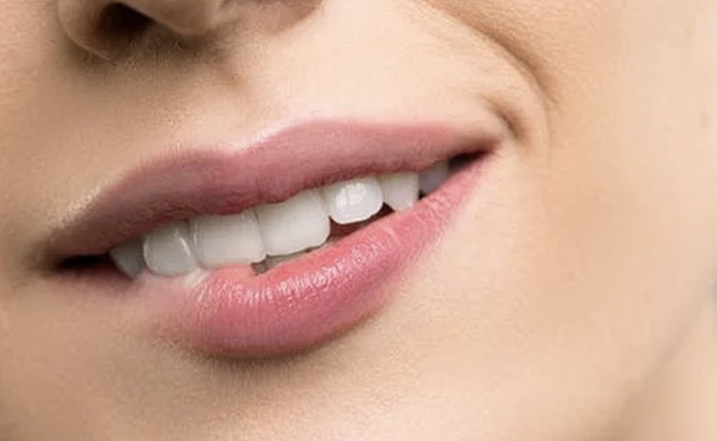 Your Complete Expert Guide To Lip Fillers: What To Expect, Benefits, Side Effects