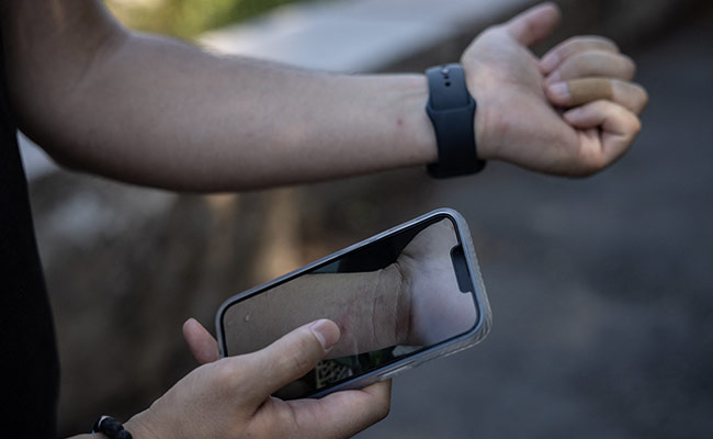 Monkeypox Symptoms, Prevention As India Records 4 Cases