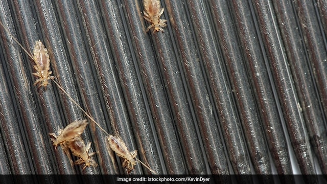 How A Paediatrician Treats Lice In Children Without Stigma