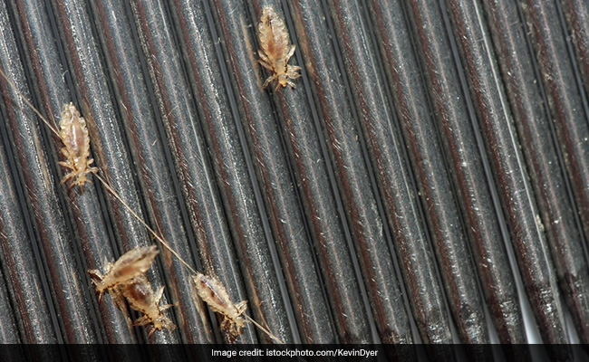 How A Paediatrician Treats Lice In Children Without Stigma