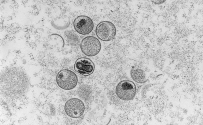 Indian Airports, Borders On Alert As Global Mpox Cases Rise: 10 Points