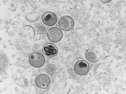 Monkeypox Declared Global Health Emergency By WHO Amid Rising Cases