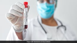 No Need To Panic: NITI Aayog member VK Paul On Monkeypox