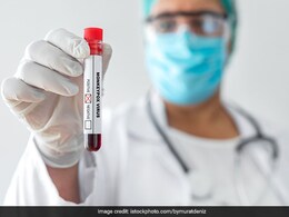 No Need To Panic: NITI Aayog member VK Paul On Monkeypox No Need To Panic: NITI Aayog member VK Paul On Monkeypox