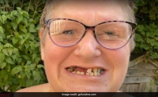 UK Woman Couldn't Find A Dentist, So She Pulled Out 13 Of Her Own Teeth: Report