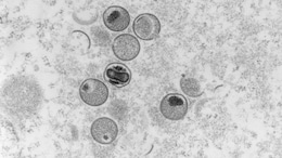 Is Monkeypox Global Health Emergency? WHO Experts Discuss Alarm Level
