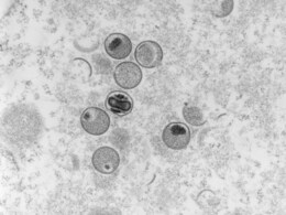 Is Monkeypox Global Health Emergency? WHO Experts Discuss Alarm Level