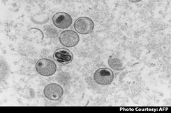 Delhi's 1st Monkeypox Case: 31-Year-Old Man With No Foreign Travel History Delhi's 1st Monkeypox Case: 31-Year-Old Man With No Foreign Travel History