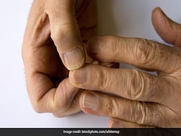 क्या आप भी बढ़े हुए कोलेस्ट्रॉल की समस्या से परेशान हो गए हैं, तो अपनाएं ये कारगर उपाय क्या आप भी बढ़े हुए कोलेस्ट्रॉल की समस्या से परेशान हो गए हैं, तो अपनाएं ये कारगर उपाय