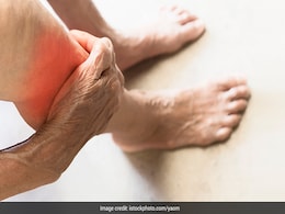 इन लोगों में बढ़ जाता है Vitamin D की कमी का खतरा, जानें शरीर के लिए क्यों और कितना जरूरी है विटामिन डी इन लोगों में बढ़ जाता है Vitamin D की कमी का खतरा, जानें शरीर के लिए क्यों और कितना जरूरी है विटामिन डी