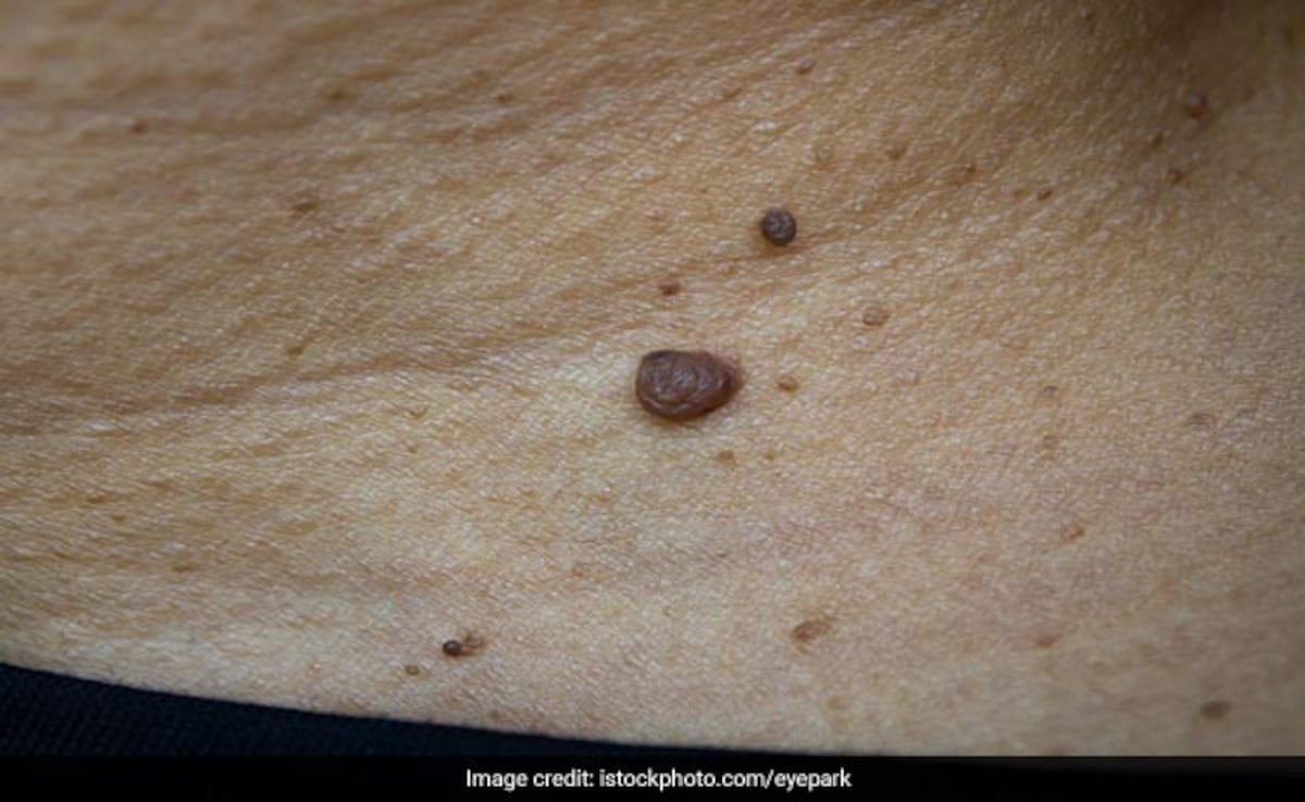 Latest and Breaking News on NDTV Latest and Breaking News on NDTV