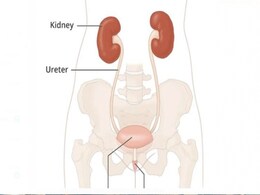 मरीज की बायीं किडनी को निकालकर दाहिने तरफ प्रत्यारोपित कर सर गंगा राम हॉस्पिटल ने किया कमाल मरीज की बायीं किडनी को निकालकर दाहिने तरफ प्रत्यारोपित कर सर गंगा राम हॉस्पिटल ने किया कमाल
