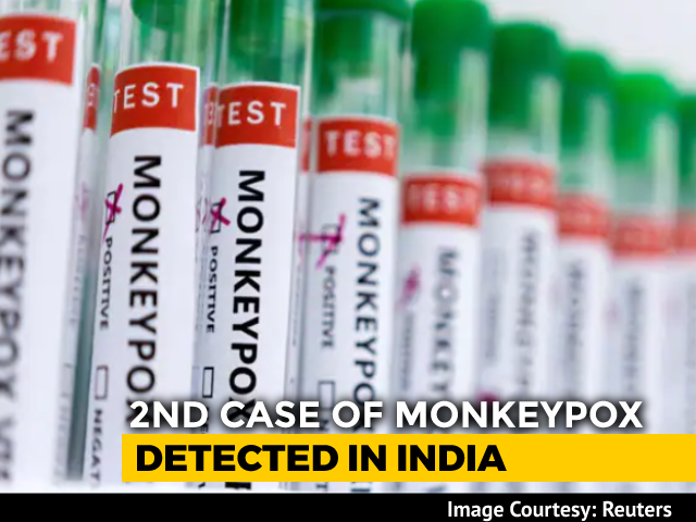 India's Second Monkeypox Case In Kerala's Kannur, Man Travelled From Dubai