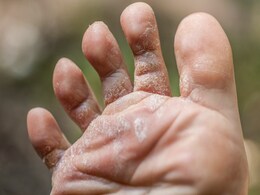 Monsoon में बारिश के पानी से पैरों में ना हो फंगल इंफेक्शन, तो इन 5 बातों का जरूर रखें ध्यान Monsoon में बारिश के पानी से पैरों में ना हो फंगल इंफेक्शन, तो इन 5 बातों का जरूर रखें ध्यान