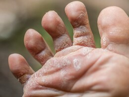 Fungal Infection: बरसात की वजह से पैरों में हो गया है फंगल इंफेक्शन, तो अपनाएं ये आसान घरेलू उपाय Fungal Infection: बरसात की वजह से पैरों में हो गया है फंगल इंफेक्शन, तो अपनाएं ये आसान घरेलू उपाय