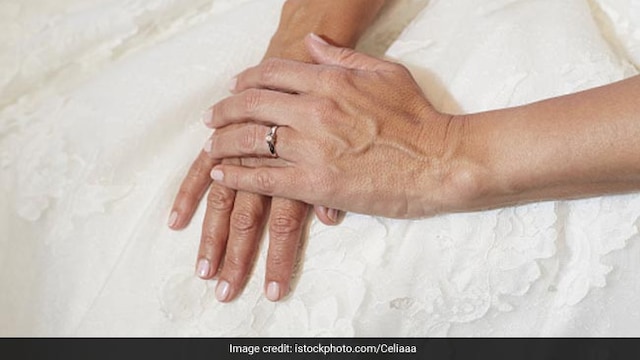 DVT can be caused by anything that slows the flow of blood through