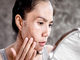 चेहरे पर पड़ने लगे हैं काले धब्बे तो आजमाकर देखें ये 9 टिप्स, Dark Spots होने लगेंगे दूर और चेहरे पर आएगा निखार चेहरे पर पड़ने लगे हैं काले धब्बे तो आजमाकर देखें ये 9 टिप्स, Dark Spots होने लगेंगे दूर और चेहरे पर आएगा निखार