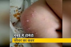 मुंबई में टोमेटो फीवर का कहर, ओपीडी में 50 फीसदी बच्चे इसी बीमारी से पीड़ित मुंबई में टोमेटो फीवर का कहर, ओपीडी में 50 फीसदी बच्चे इसी बीमारी से पीड़ित