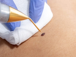 किम कार्दशियन जैसा दिखने के लिए महिला ने कराई 15 सर्जरी, बोली- अब मुझे कोई नहीं पहचानता... किम कार्दशियन जैसा दिखने के लिए महिला ने कराई 15 सर्जरी, बोली- अब मुझे कोई नहीं पहचानता...