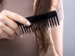 Vitamin B7 Deficiency: इस विटामिन के बिना हो सकती है बाल झड़ने जैसी दिक्कतें, जानिए किस तरह पूरी करें विटामिन बी-7 की कमी  Vitamin B7 Deficiency: इस विटामिन के बिना हो सकती है बाल झड़ने जैसी दिक्कतें, जानिए किस तरह पूरी करें विटामिन बी-7 की कमी