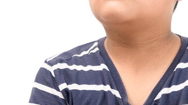 Dark pigmentation on the underarms, neck, and groin can be a sign of diabetes
