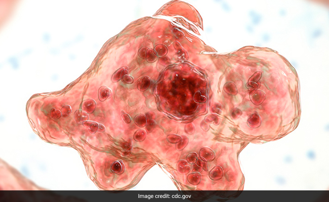 US Child Dies Of Naegleria Fowleri Infection: 5 Points On 'Brain-Eating Amoeba'
