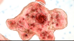 Brain-Eating Amoeba Claims Third Victim In Kerala: How To Prevent Infection