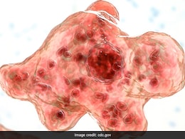 Brain-Eating Amoeba Claims Third Victim In Kerala: How To Prevent Infection Brain-Eating Amoeba Claims Third Victim In Kerala: How To Prevent Infection