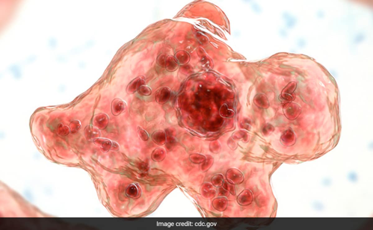 Beyond Brain-Eating Amoeba: Scientists Warn Of Rising Threat To Global Health