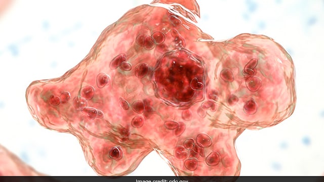 Beyond Brain-Eating Amoeba: Scientists Warn Of Rising Threat To Global Health