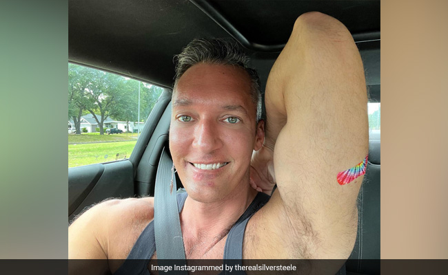Gay Adult Film Actor's Graphic Post Of Painful Monkeypox Rash Goes Viral
