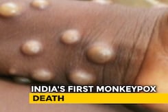 India Reports Asia's First Possible Monkeypox Death India Reports Asia's First Possible Monkeypox Death
