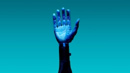 ENRICH: India's Affordable EMG-Controlled Prosthetic Hand