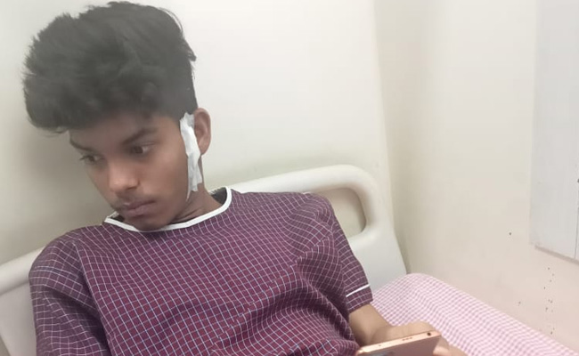"Papa, There's Fire...": Teen's Last Words From Madhya Pradesh Hospital Where 8 Died