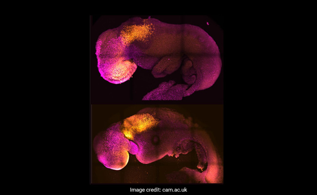 Scientists Create World's First "Synthetic" Embryo With Brain, Beating Heart: Report